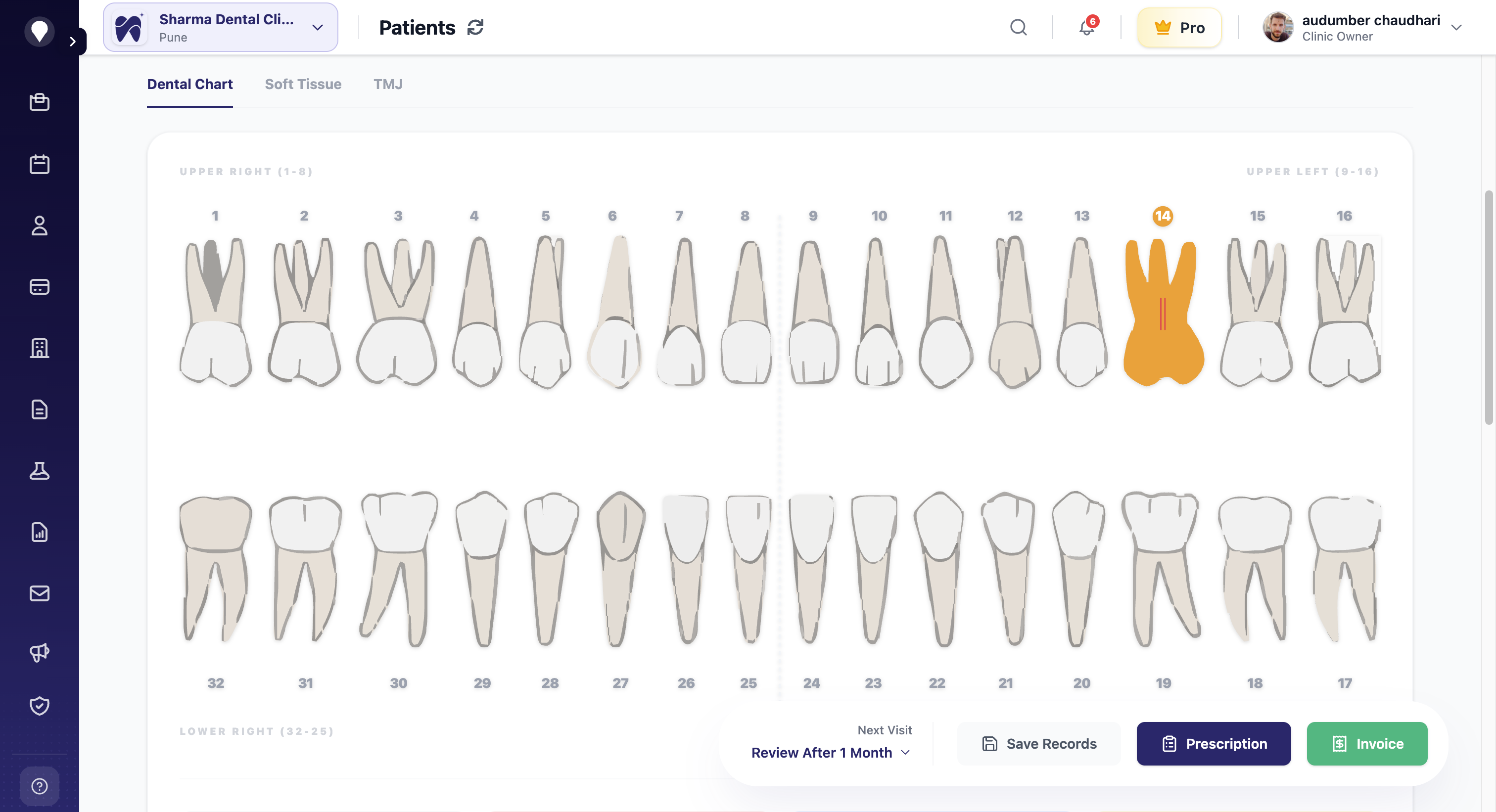 MolarPlus Treatment Planning & Charts screenshot